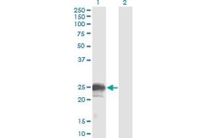 Image no. 1 for anti-Neuroblastoma 1, DAN Family BMP Antagonist (NBL1) (AA 21-130) antibody (ABIN518196)