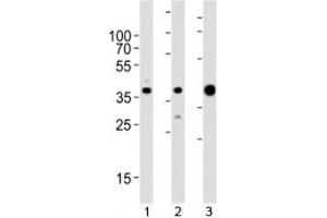 Image no. 2 for anti-Aldolase A, Fructose-Bisphosphate (ALDOA) (AA 303-331) antibody (ABIN3029902)