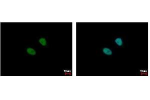 Image no. 4 for anti-Male-Specific Lethal 3 Homolog (MSL3) (Center) antibody (ABIN2856148)