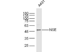 Image no. 6 for anti-Enolase 2 (Gamma, Neuronal) (ENO2) (AA 201-300) antibody (ABIN736581)