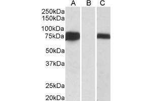 Image no. 4 for anti-Forkhead Box C1 (FOXC1) (C-Term) antibody (ABIN185028)
