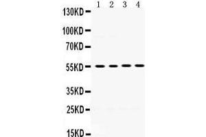 Image no. 2 for anti-Matrix Metallopeptidase 8 (Neutrophil Collagenase) (MMP8) (AA 120-157), (N-Term) antibody (ABIN3043883)