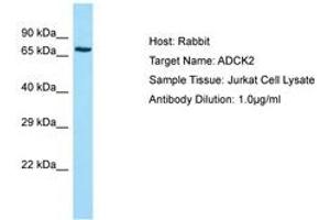 Image no. 1 for anti-AarF Domain Containing Kinase 2 (ADCK2) (AA 257-306) antibody (ABIN6749962)