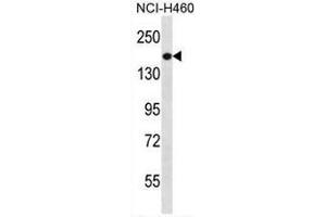 Image no. 3 for anti-Phosphatidylinositol-3,4,5-Trisphosphate-Dependent Rac Exchange Factor 1 (PREX1) (AA 1133-1163), (C-Term) antibody (ABIN954297)