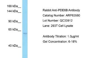 Image no. 1 for anti-phosphodiesterase 6B, CGMP-Specific, Rod, beta (PDE6B) (C-Term) antibody (ABIN2789553)