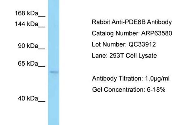 anti-phosphodiesterase 6B, CGMP-Specific, Rod, beta (PDE6B) (C-Term) antibody