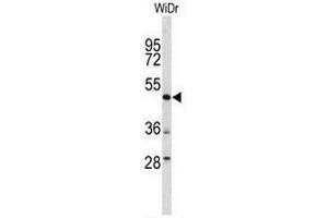 Image no. 4 for anti-DEK Oncogene (DEK) (AA 343-372), (C-Term) antibody (ABIN951879)