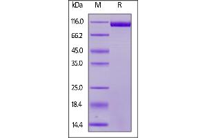 Image no. 2 for CD22 Molecule (CD22) (AA 20-687) protein (His tag) (ABIN5526644)