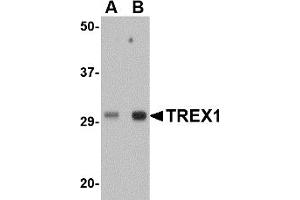 Image no. 1 for anti-three Prime Repair Exonuclease 1 (TREX1) (Middle Region) antibody (ABIN1031144)