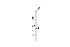 MSX1 anticorps  (AA 111-138)
