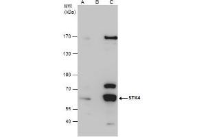 Image no. 4 for anti-serine/threonine Kinase 4 (STK4) (C-Term) antibody (ABIN2856667)