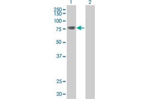 Image no. 1 for anti-Topoisomerase (DNA) III beta (TOP3B) (AA 1-862) antibody (ABIN522416)