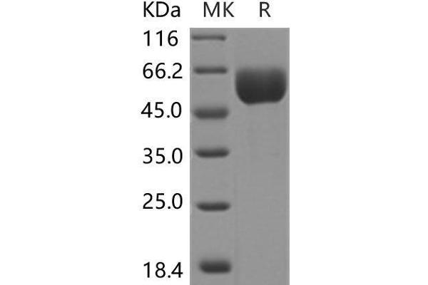 SMPDL3A Protein (His tag)