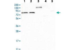 Image no. 2 for anti-TBC1 Domain Family, Member 30 (TBC1D30) antibody (ABIN5589230)
