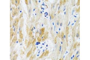 Immunohistochemistry of paraffin-embedded Mouse heart using PHPT1 Polyclonal Antibody at dilution of 1:100 (40x lens).