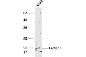 Image no. 1 for anti-Profilin 2 (PFN2) (AA 51-140) antibody (ABIN735728)