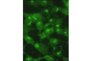 Immunocytochemistry (ICC) image for anti-Microtubule-Associated Protein 1 Light Chain 3 alpha (MAP1LC3A) (C-Term), (Cleavage Site), (cleaved) antibody (ABIN2161193)