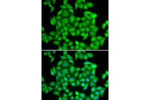 Image no. 20 for anti-Heterogeneous Nuclear Ribonucleoprotein A2/B1 (HNRNPA2B1) antibody (ABIN3021593)