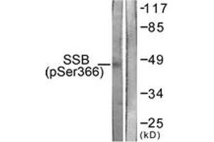 Western blot analysis of extracts from 293 cells, using SSB (Phospho-Ser366) Antibody.