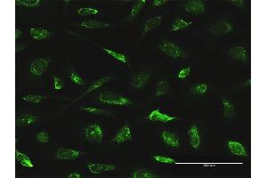 Image no. 4 for anti-Apoptosis-Inducing Factor, Mitochondrion-Associated, 1 (AIFM1) (AA 1-613) antibody (ABIN522589)