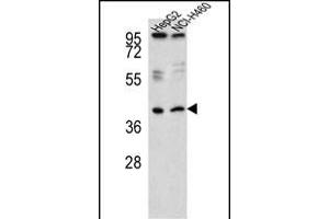 RSAD1 antibody  (C-Term)