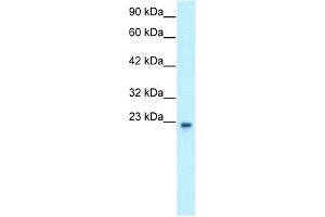 Image no. 4 for anti-General Transcription Factor IIF, Polypeptide 2, 30kDa (GTF2F2) (Middle Region) antibody (ABIN2777297)