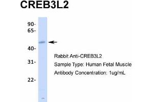 Image no. 5 for anti-CAMP Responsive Element Binding Protein 3-Like 2 (CREB3L2) (N-Term) antibody (ABIN2775946)