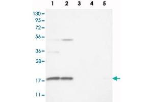 Image no. 3 for anti-Ribosomal Protein S25 (RPS25) antibody (ABIN5587182)