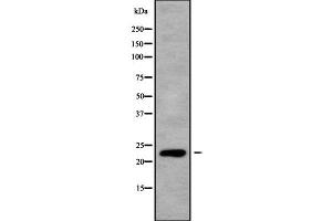 Image no. 1 for anti-V-Ral Simian Leukemia Viral Oncogene Homolog B (Ras Related, GTP Binding Protein) (Ralb) (C-Term) antibody (ABIN6264625)