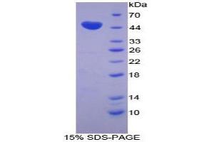Image no. 1 for Chromogranin B (Secretogranin 1) (CHGB) protein (ABIN3008787)
