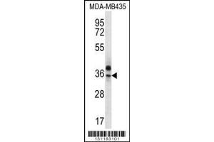 Image no. 1 for anti-Olfactory Receptor, Family 51, Subfamily Q, Member 1 (OR51Q1) (AA 34-62), (N-Term) antibody (ABIN656253)