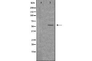 Image no. 1 for anti-Activin A Receptor Type II-Like 1 (ACVRL1) antibody (ABIN6256992)