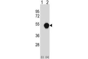 Image no. 1 for anti-PX domain-containing protein kinase-like protein (PXK) (AA 221-251) antibody (ABIN3028958)