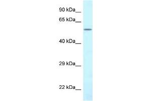 Image no. 2 for anti-CTP Synthase II (CTPS2) (N-Term) antibody (ABIN2789147)