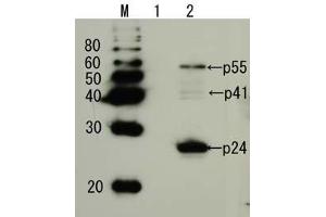 Image no. 2 for anti-Human Immunodeficiency Virus 1 Capsid (HIV-1 p24) (full length) antibody (ABIN2452021)