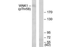 Western blot analysis of extracts from 293 cells treated with EGF 200ng/ml 30', using WNK1 (Phospho-Thr58) Antibody.