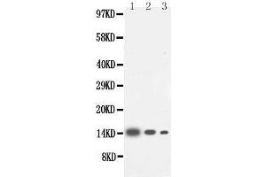 Image no. 1 for anti-Interleukin 4 (IL4) (AA 72-98), (Middle Region) antibody (ABIN3042695)