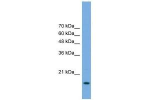 Image no. 1 for anti-Processing of Precursor 5, Ribonuclease P/MRP Subunit (POP5) (Middle Region) antibody (ABIN928895)