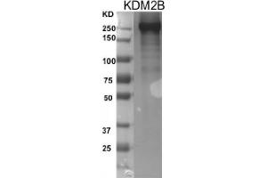 KDM2B Protein (DYKDDDDK Tag)