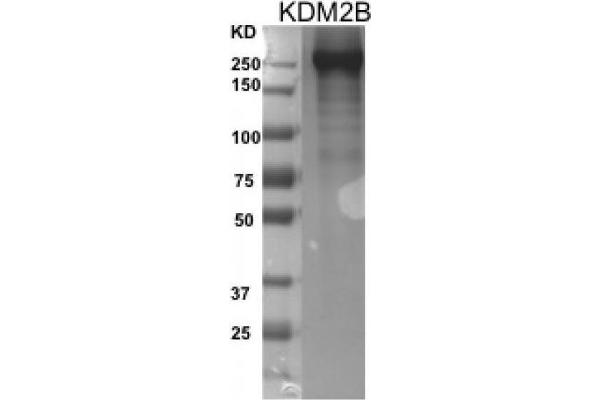 KDM2B Protein (DYKDDDDK Tag)