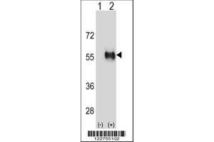 Image no. 3 for anti-Aldehyde Dehydrogenase 3 Family, Member B1 (ALDH3B1) (AA 334-360) antibody (ABIN652651)