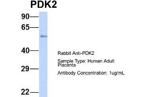 Image no. 1 for anti-3-phosphoinositide Dependent Protein Kinase-1 (PDPK1) (Middle Region) antibody (ABIN2777432)