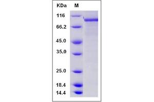 Image no. 1 for phosphodiesterase 1C, Calmodulin-Dependent 70kDa (PDE1C) (AA 1-634) protein (GST tag,His tag) (ABIN2005804)