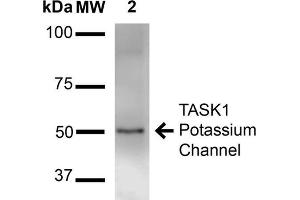 Image no. 2 for anti-Potassium Channel, Subfamily K, Member 3 (KCNK3) (AA 251-411) antibody (FITC) (ABIN1741497)