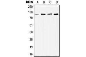 Image no. 1 for anti-Histone Deacetylase 5 (HDAC5) (Center) antibody (ABIN2706307)
