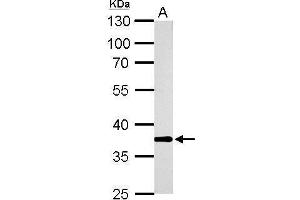 Image no. 5 for anti-Aldo-Keto Reductase Family 1, Member B10 (Aldose Reductase) (AKR1B10) (full length) antibody (ABIN2856687)