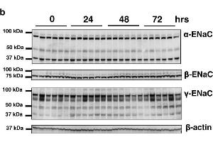 Image no. 1 for anti-Sodium Channel, Nonvoltage-Gated 1 alpha (SCNN1A) (AA 46-68) antibody (ABIN863202)