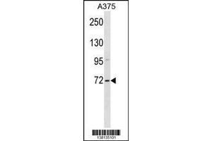anti-Zinc Finger, SWIM-Type Containing 2 (ZSWIM2) (AA 435-462), (C-Term) antibody
