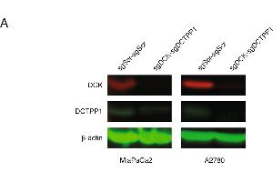 Image no. 7 for anti-Deoxycytidine Kinase (DCK) (Center) antibody (ABIN2855484)