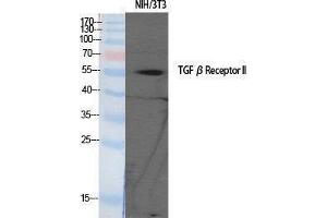 Image no. 1 for anti-Transforming Growth Factor, beta Receptor II (70/80kDa) (TGFBR2) (Tyr159) antibody (ABIN3187247)